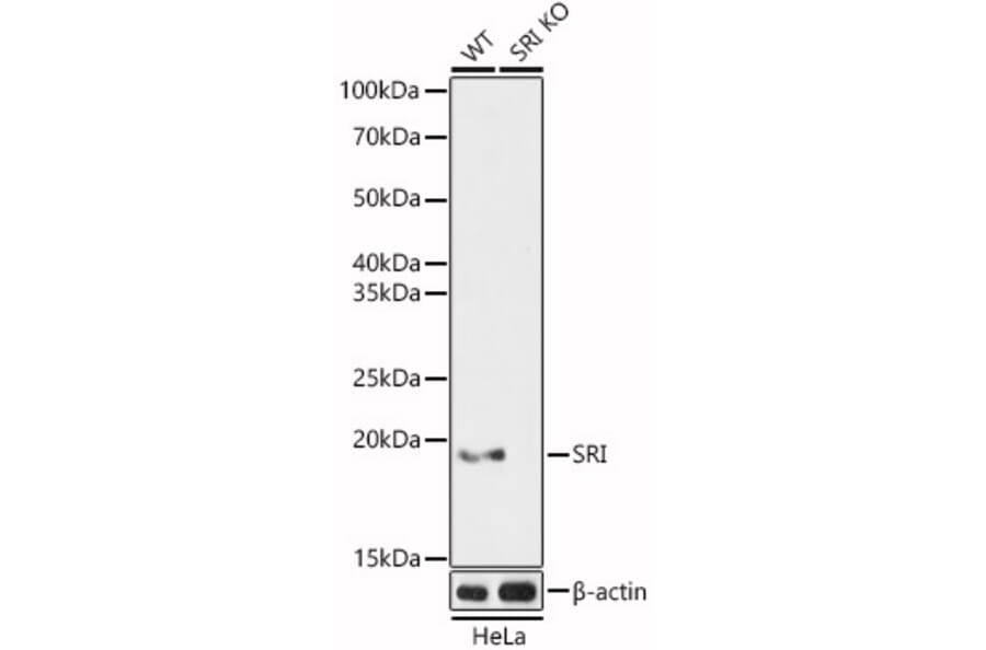 Western Blot - Anti-SR1 Antibody (A15361) - Antibodies.com