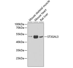 Western Blot - Anti-ST3GAL3 Antibody (A15362) - Antibodies.com