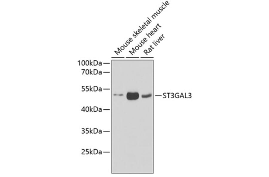 Western Blot - Anti-ST3GAL3 Antibody (A15362) - Antibodies.com