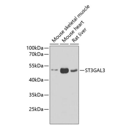 Western Blot - Anti-ST3GAL3 Antibody (A15362) - Antibodies.com