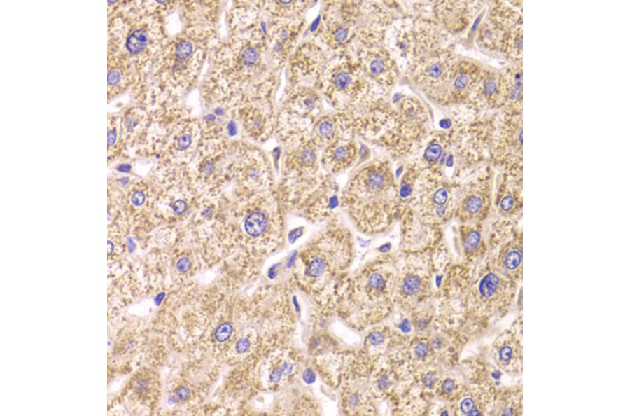 Immunohistochemistry - Anti-ST3GAL3 Antibody (A15362) - Antibodies.com