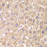 Immunohistochemistry - Anti-ST3GAL3 Antibody (A15362) - Antibodies.com