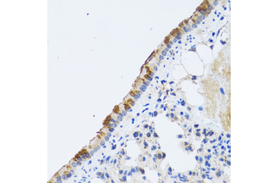 Immunohistochemistry - Anti-ST3GAL3 Antibody (A15362) - Antibodies.com