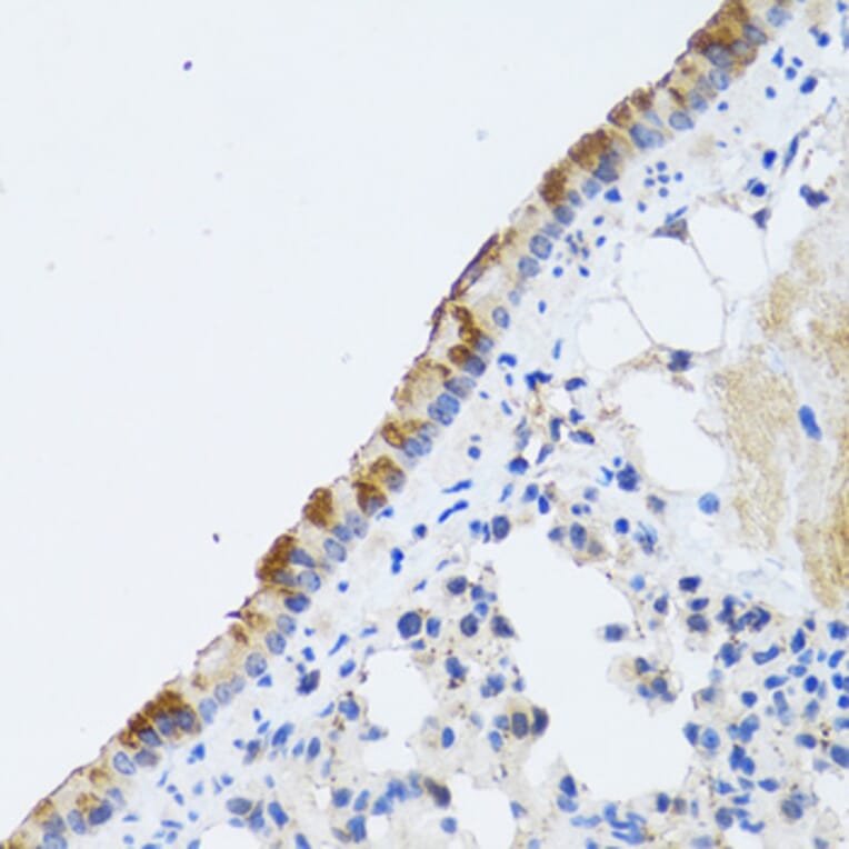 Immunohistochemistry - Anti-ST3GAL3 Antibody (A15362) - Antibodies.com