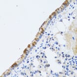 Immunohistochemistry - Anti-ST3GAL3 Antibody (A15362) - Antibodies.com