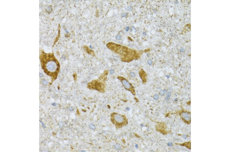 Immunohistochemistry - Anti-ST3GAL3 Antibody (A15362) - Antibodies.com