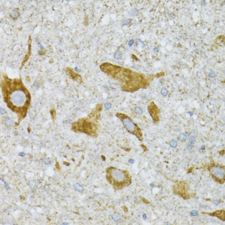 Immunohistochemistry - Anti-ST3GAL3 Antibody (A15362) - Antibodies.com