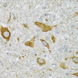 Immunohistochemistry - Anti-ST3GAL3 Antibody (A15362) - Antibodies.com