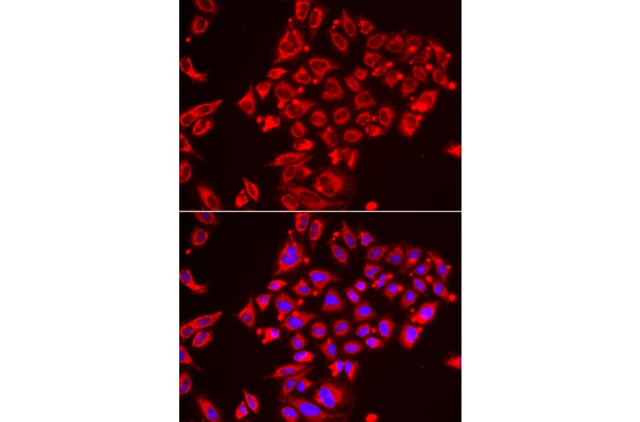 Immunofluorescence - Anti-ST3GAL3 Antibody (A15362) - Antibodies.com