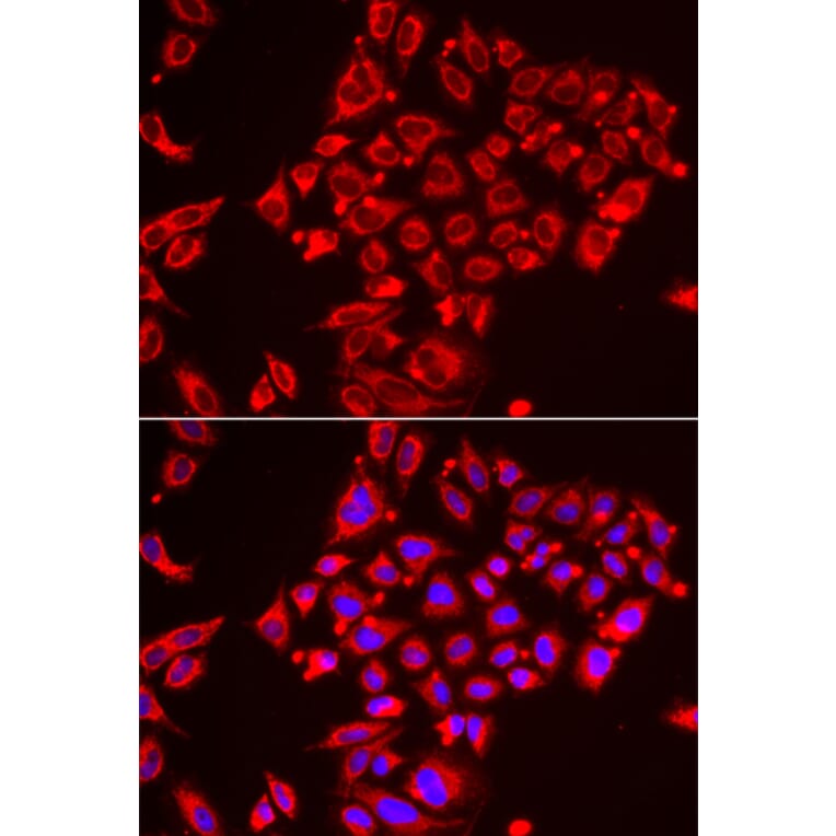 Immunofluorescence - Anti-ST3GAL3 Antibody (A15362) - Antibodies.com
