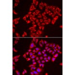Immunofluorescence - Anti-ST3GAL3 Antibody (A15362) - Antibodies.com