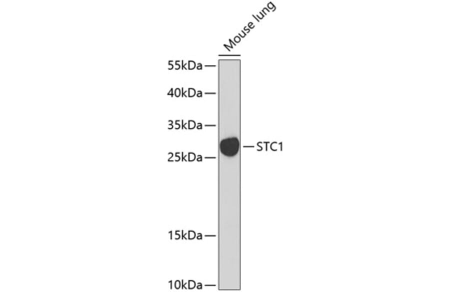 Western Blot - Anti-Stanniocalcin 1/STC Antibody (A15363) - Antibodies.com