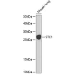 Western Blot - Anti-Stanniocalcin 1/STC Antibody (A15363) - Antibodies.com