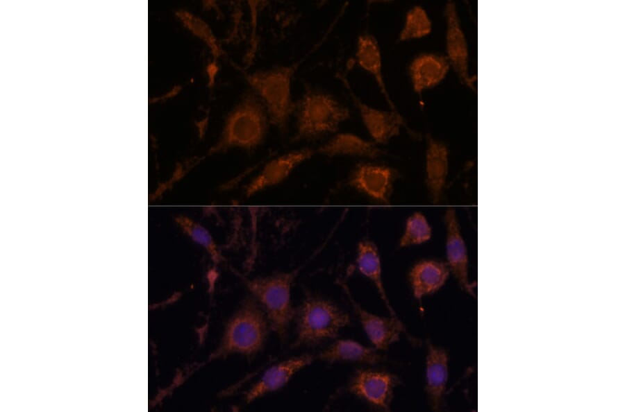 Immunofluorescence - Anti-Stanniocalcin 1/STC Antibody (A15363) - Antibodies.com