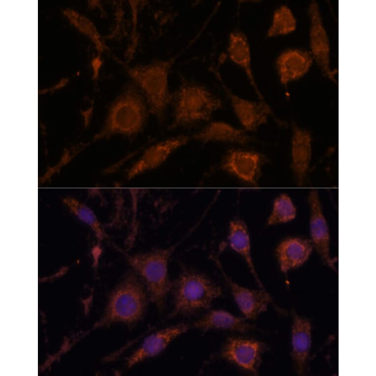 Immunofluorescence - Anti-Stanniocalcin 1/STC Antibody (A15363) - Antibodies.com