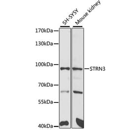 Western Blot - Anti-SG2NA Antibody (A15364) - Antibodies.com