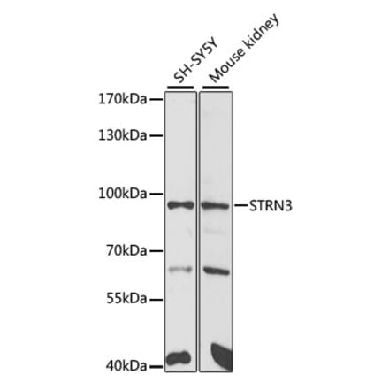 Western Blot - Anti-SG2NA Antibody (A15364) - Antibodies.com