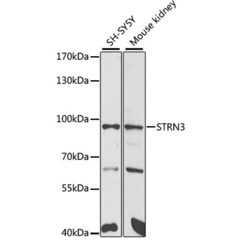 Western Blot - Anti-SG2NA Antibody (A15364) - Antibodies.com