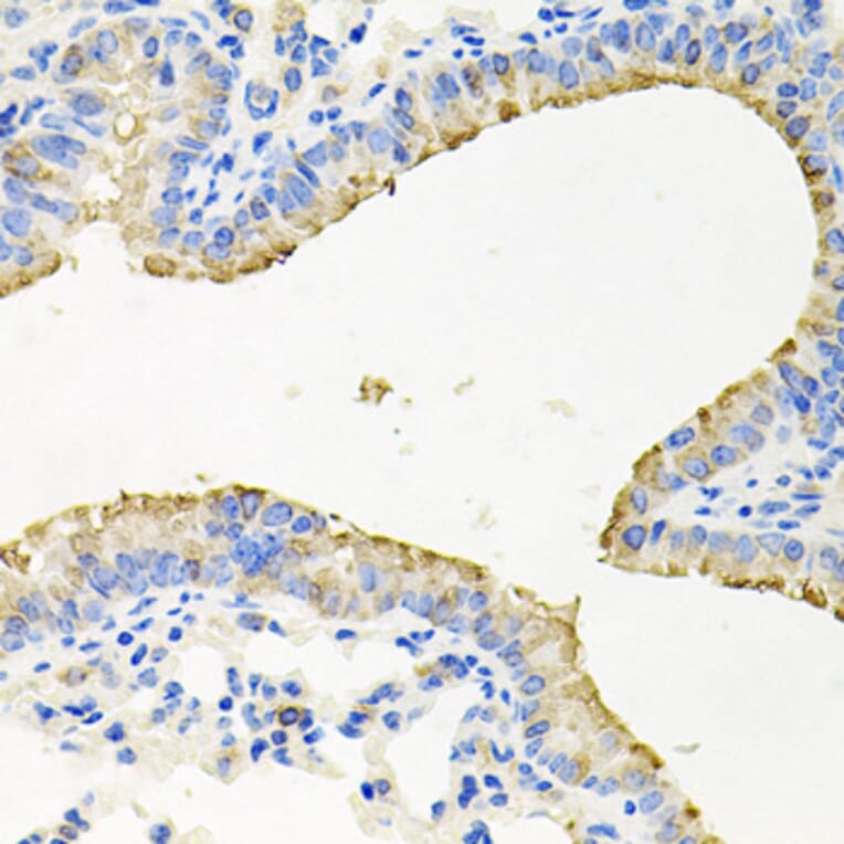 Immunohistochemistry - Anti-SG2NA Antibody (A15364) - Antibodies.com