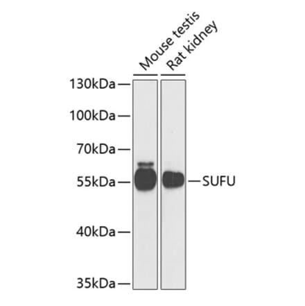 Western Blot - Anti-SUFU Antibody (A15365) - Antibodies.com