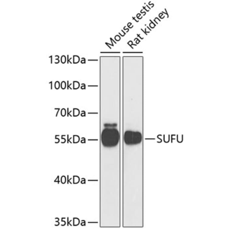 Western Blot - Anti-SUFU Antibody (A15365) - Antibodies.com