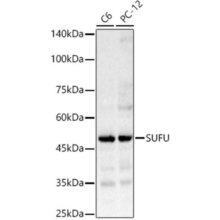 Western Blot - Anti-SUFU Antibody (A15365) - Antibodies.com