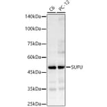 Western Blot - Anti-SUFU Antibody (A15365) - Antibodies.com