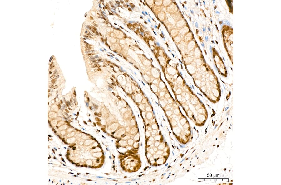 Immunohistochemistry - Anti-SUFU Antibody (A15365) - Antibodies.com