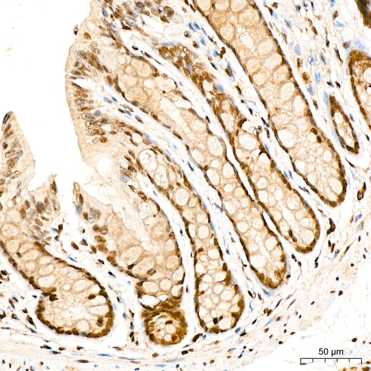 Immunohistochemistry - Anti-SUFU Antibody (A15365) - Antibodies.com