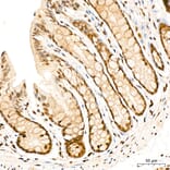 Immunohistochemistry - Anti-SUFU Antibody (A15365) - Antibodies.com