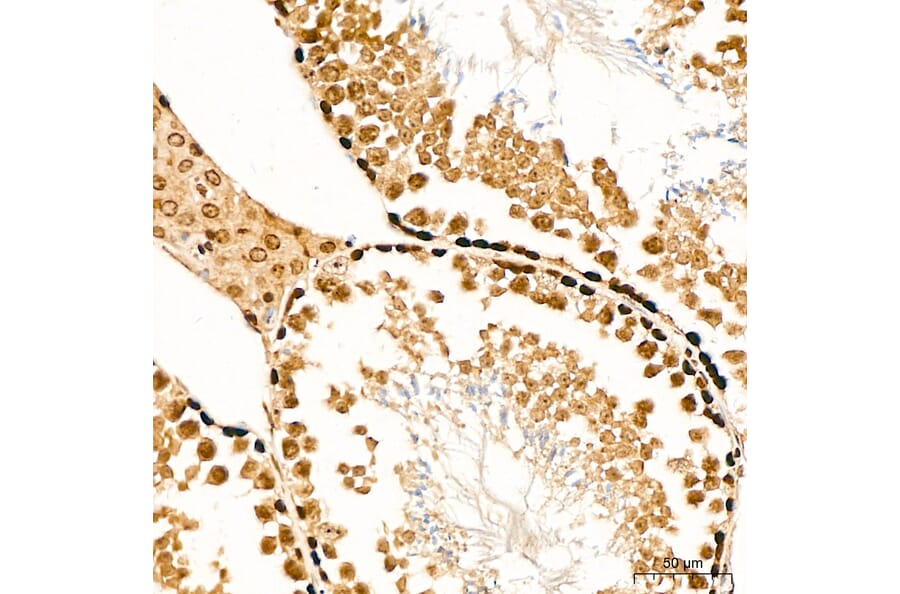 Immunohistochemistry - Anti-SUFU Antibody (A15365) - Antibodies.com