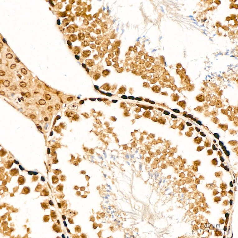 Immunohistochemistry - Anti-SUFU Antibody (A15365) - Antibodies.com