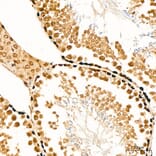 Immunohistochemistry - Anti-SUFU Antibody (A15365) - Antibodies.com