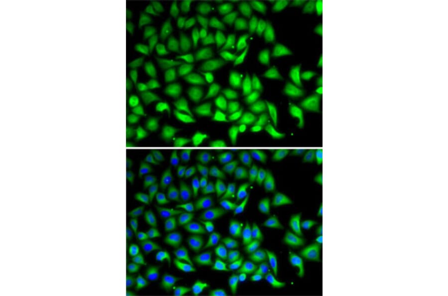 Immunofluorescence - Anti-SUFU Antibody (A15365) - Antibodies.com