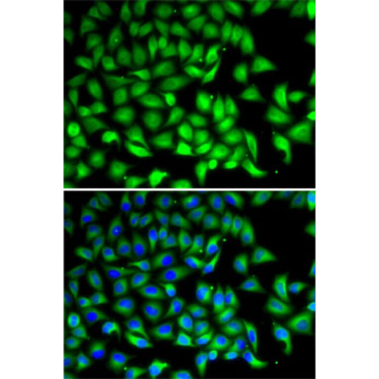 Immunofluorescence - Anti-SUFU Antibody (A15365) - Antibodies.com