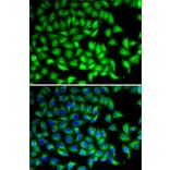 Immunofluorescence - Anti-SUFU Antibody (A15365) - Antibodies.com