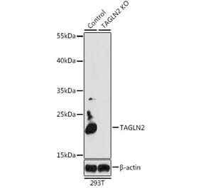 Western Blot - Anti-TAGLN2 Antibody (A15366) - Antibodies.com