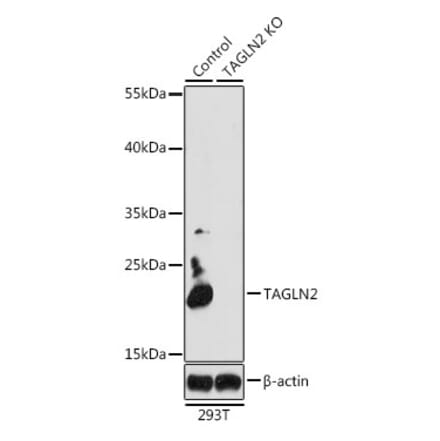 Western Blot - Anti-TAGLN2 Antibody (A15366) - Antibodies.com