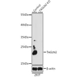 Western Blot - Anti-TAGLN2 Antibody (A15366) - Antibodies.com