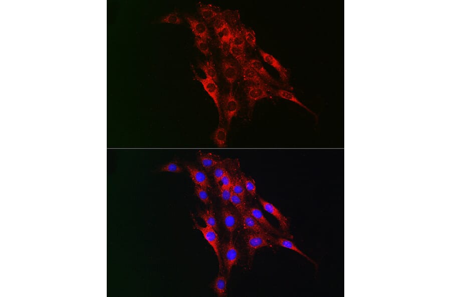 Immunofluorescence - Anti-TAGLN2 Antibody (A15366) - Antibodies.com