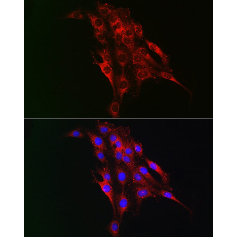 Immunofluorescence - Anti-TAGLN2 Antibody (A15366) - Antibodies.com