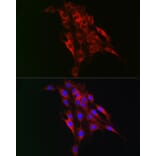 Immunofluorescence - Anti-TAGLN2 Antibody (A15366) - Antibodies.com