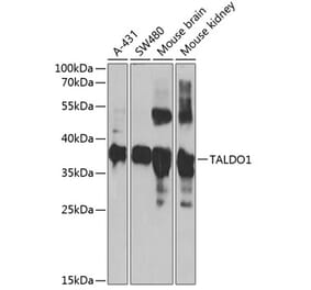 Western Blot - Anti-Transaldolase 1 Antibody (A15367) - Antibodies.com