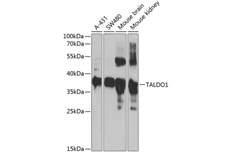 Western Blot - Anti-Transaldolase 1 Antibody (A15367) - Antibodies.com