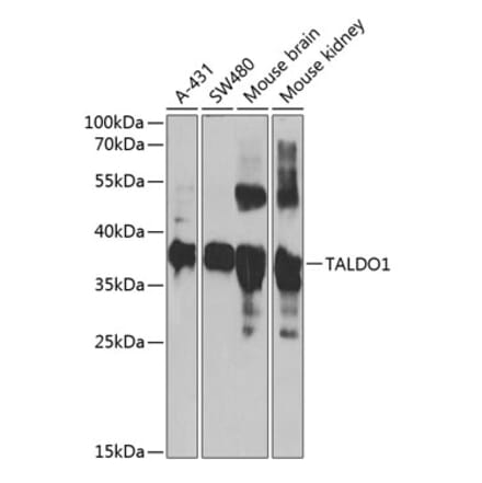 Western Blot - Anti-Transaldolase 1 Antibody (A15367) - Antibodies.com