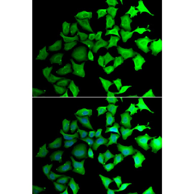 Immunofluorescence - Anti-Transaldolase 1 Antibody (A15367) - Antibodies.com