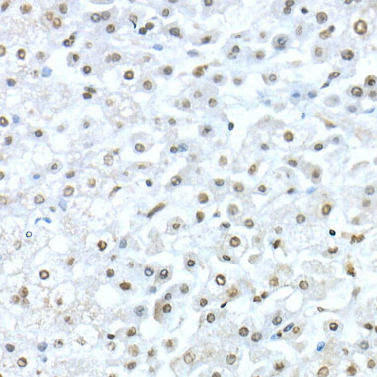 Immunohistochemistry - Anti-TEF1/TEAD-1 Antibody (A15368) - Antibodies.com