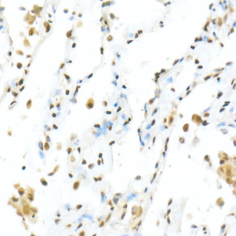 Immunohistochemistry - Anti-TEF1/TEAD-1 Antibody (A15368) - Antibodies.com