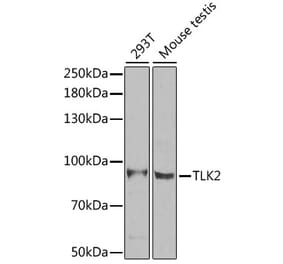 Western Blot - Anti-TLK2 Antibody (A15369) - Antibodies.com