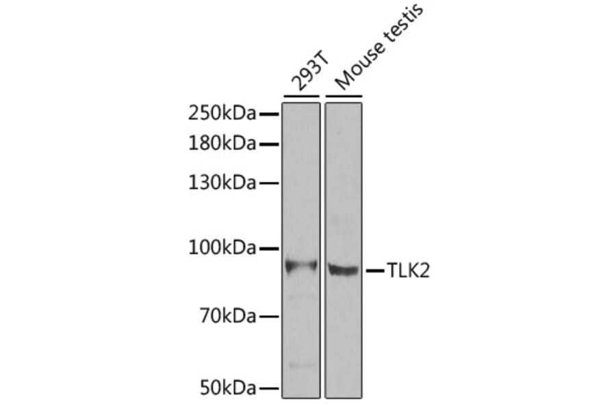 Western Blot - Anti-TLK2 Antibody (A15369) - Antibodies.com